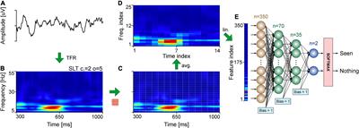 Time-Frequency Representations of Brain Oscillations: Which One Is Better?